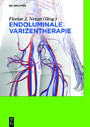 Endoluminale Varizentherapie