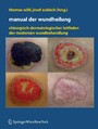 Manual der Wundheilung - Chirurgisch-dermatologischer Leitfaden der modernen Wundbehandlung