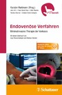 Endovenöse Verfahren - Minimalinvasive Therapie der Varikosis - griffbereit - Zusätzlich online, auch über QR-Codes: 11 OP-Videos