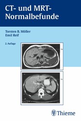 CT und MRT Normalbefunde - . Zus.-Arb.: T. B. Möller, E. R. Reif