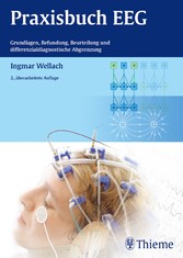 Praxisbuch EEG - Grundlagen, Befundung, Beurteilung und differenzialdiagnostische Abgrenzung Praxisbuch EEG - Grundlagen, Befundung, Beurteilung und differenzialdiagnostische Abgrenzung