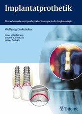Implantatprothetik - Biomechanische und prothetische Konzepte in der Implantologie