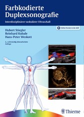 Farbkodierte Duplexsonografie - Interdisziplinärer vaskulärer Ultraschall