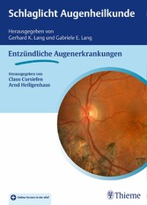 Schlaglicht Augenheilkunde: Entzündliche Erkrankungen