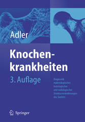 Knochenkrankheiten