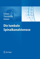 Die lumbale Spinalkanalstenose