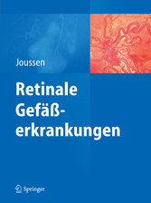 Retinale Gefäßerkrankungen