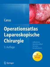 Operationsatlas Laparoskopische Chirurgie - Indikationen - Operationsablauf - Varianten - Komplikationen