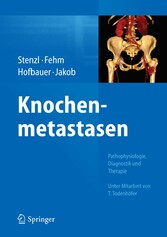 Knochenmetastasen - Pathophysiologie, Diagnostik und Therapie - Unter Mitarbeit von T. Todenhöfer Knochenmetastasen - Pathophysiologie, Diagnostik und Therapie - Unter Mitarbeit von T. Todenhöfer