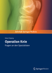 Operation Knie - Fragen an den Spezialisten